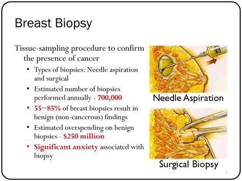 percentage of positive breast biopsies.